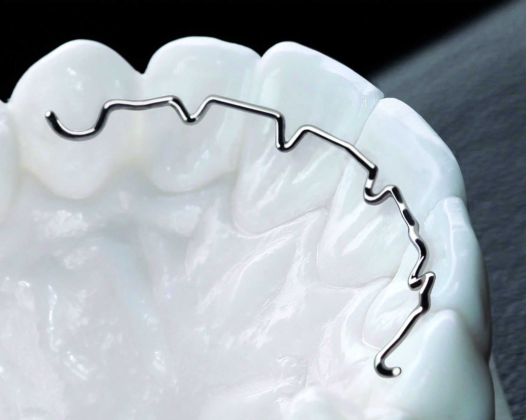 3D Titan Retainer für beste Passung bei absoluter Biokompatibilität