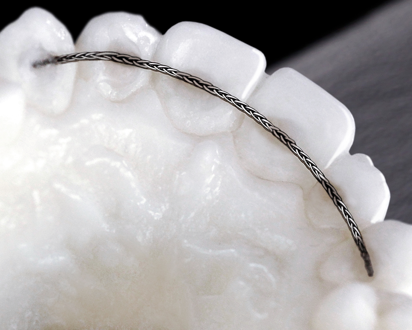 3D Titan Retainer für beste Passung bei absoluter Biokompatibilität